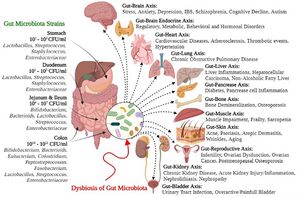 Gut microbial strains and negative health outcomes of gut microbial dysbiosis